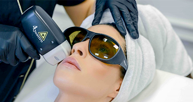 Facial Laser Hair Reduction
